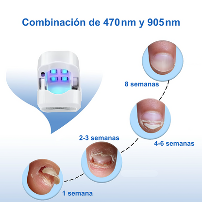 Dispositivo Láser Antihongos – Tratamiento Seguro desde Casa