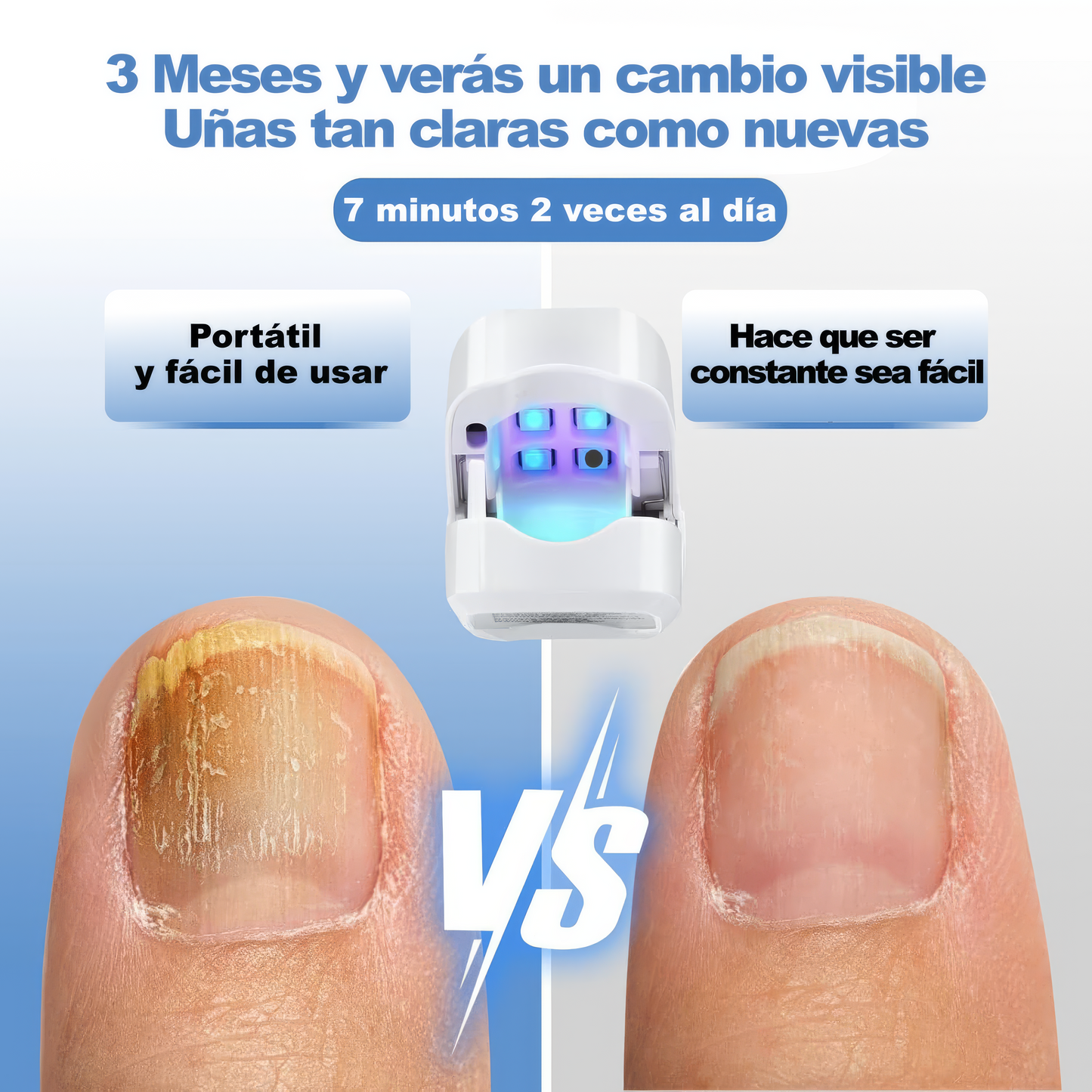 Dispositivo Láser Antihongos – Tratamiento Seguro desde Casa